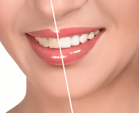 orthodontics