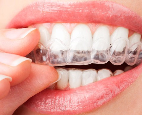 orthodontics